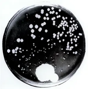 Fleming's Penicillin Dish — ranked #6