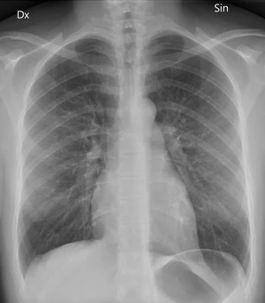 The X-ray — ranked #7
