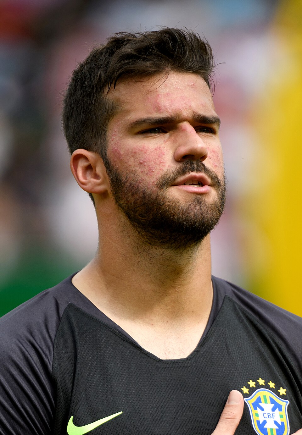 Alisson Becker - ranking option ranked #7